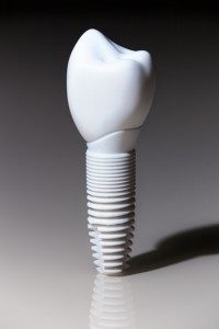 do dental implants hurt