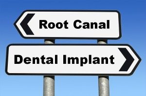implante dental de endodoncia vs.