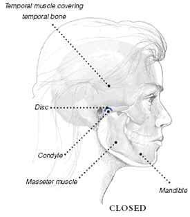 tmj disorder diagnosis