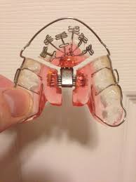 DNA appliance for TMJ