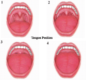 Tongue position sleep apnea