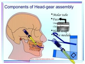 TMJ after invisalign 