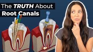 Root Canal: Procedure, What It Treats & Recovery