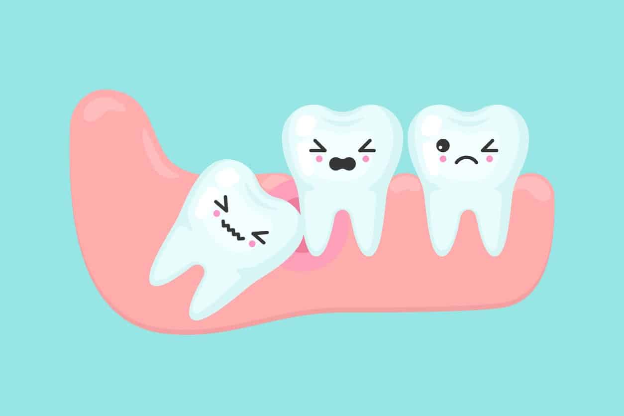 wisdom teeth removal with prf ozone