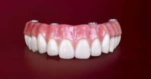 Prettau Vs Bruxzir Zirconia Vs Hybridge Acrylic Denture Teeth