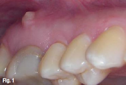 dental emergency dentist
