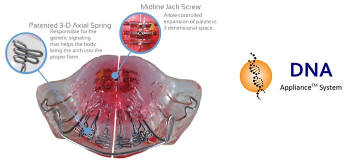 Holistic Orthodontics is an Alternative to Traditional Braces