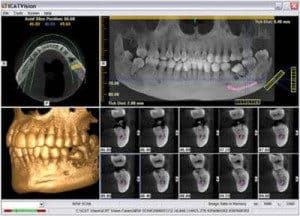 holistic oral surgery with cone beam xray