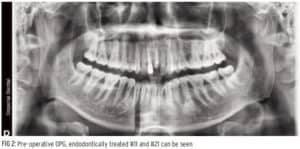non surgical jaw treatment