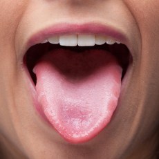 scalloped tongue tooth clenching