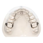 Holistic Orthodontics is an Alternative to Traditional Braces