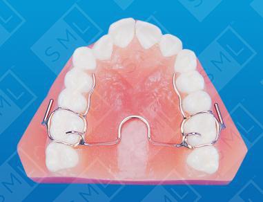 crozat maxillary expander