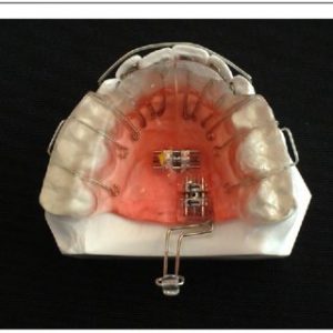 vivos dna appliance provider videos