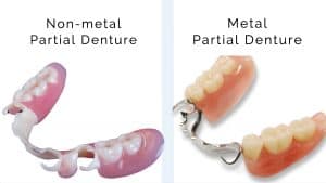 partial dentures