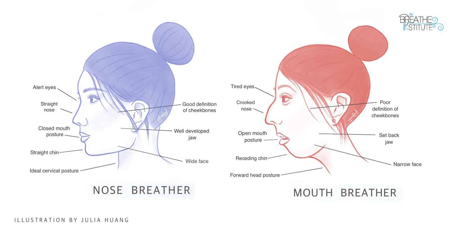 What Causes Mouth Breathing-The Root Cause of Airway and Breathing Problems?