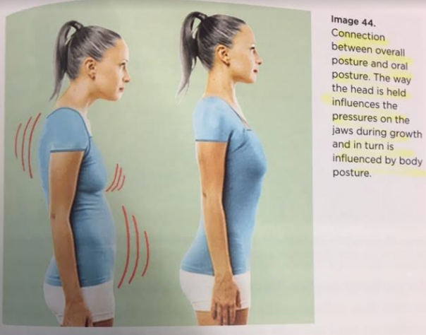 mouth breather posture