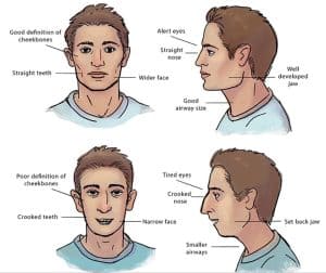 Mouth Breather vs Nose Breather Faces