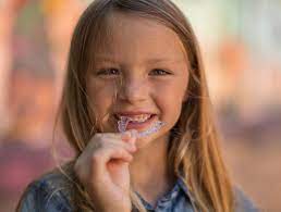 invisalign kids