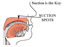 tongue suctioned in the palate