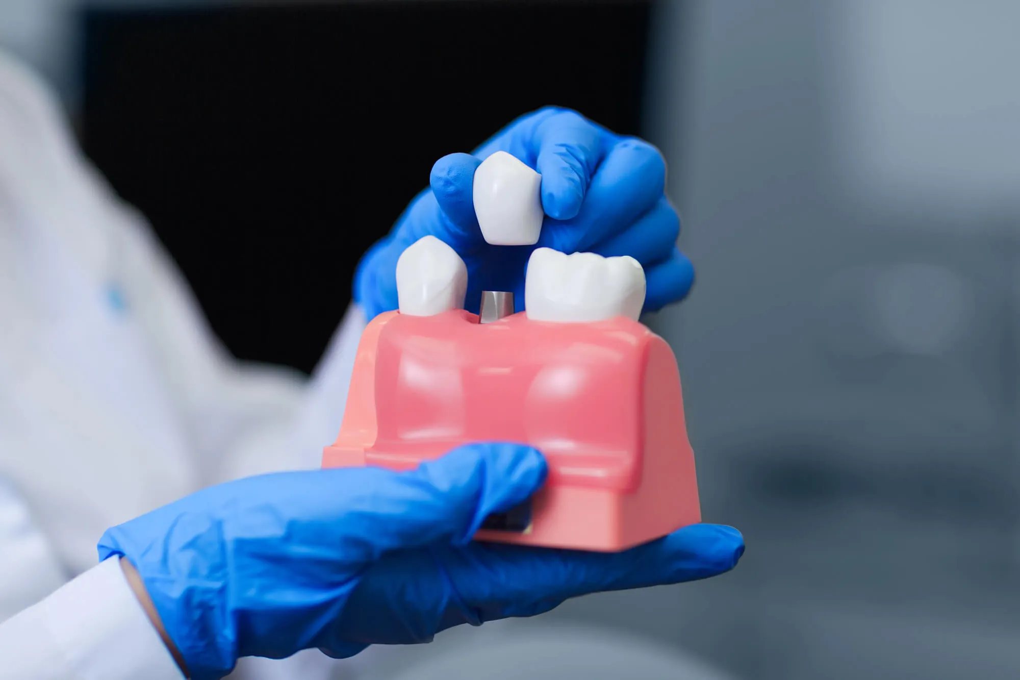 Common Signs You May Be Ready for a Tooth Implant