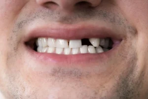 holistic dentist burtonsville md_ examines patient's mouth