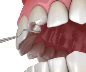 needs an evaluation by an Emergency biological dentist